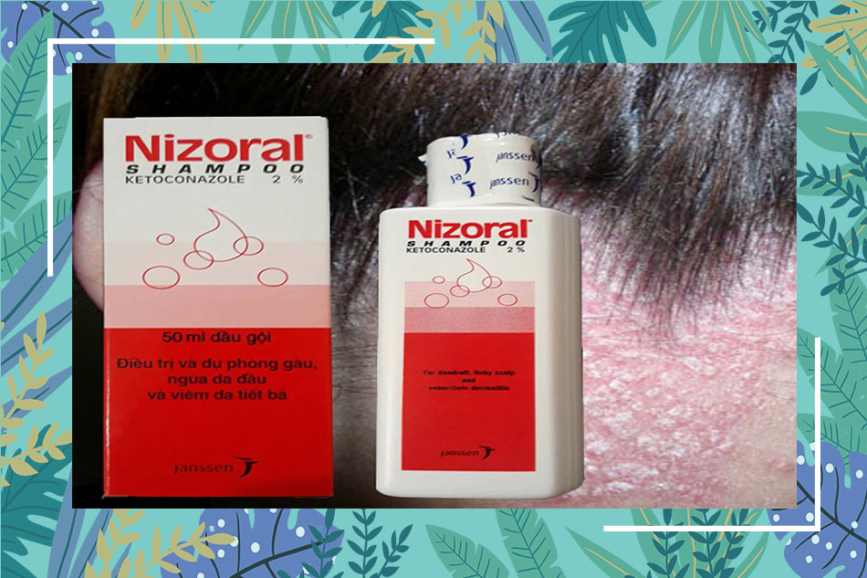 Tác dụng của dầu gội Nizoral Shampoo