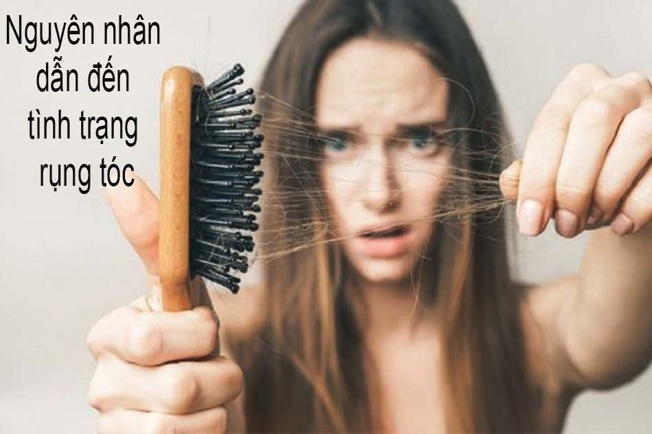 Nguyên nhân dẫn đến tình trạng rụng tóc