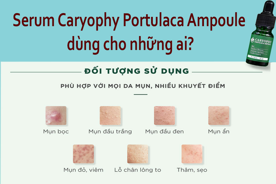 Đối tượng sử dụng serum trị mụn Caryophy Portulaca Ampoule