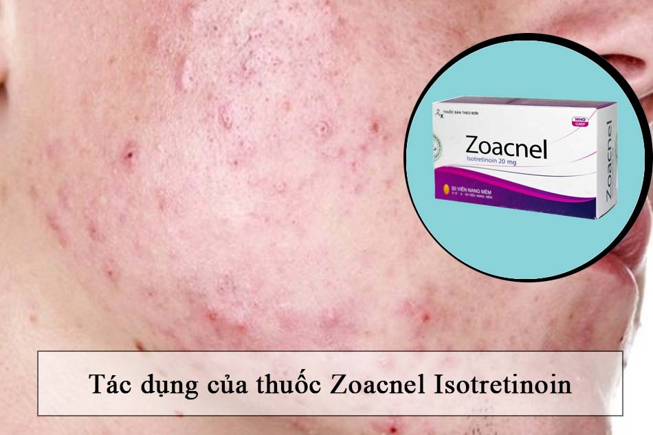 Tác dụng của thuốc Zoacnel Isotretinoin