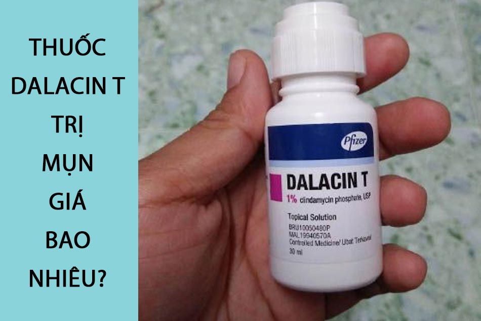 Thuốc Dalacin T trị mụn giá bao nhiêu?