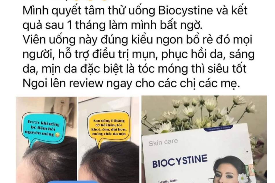 Review từ khách hàng đã dùng viên uống Biocystine